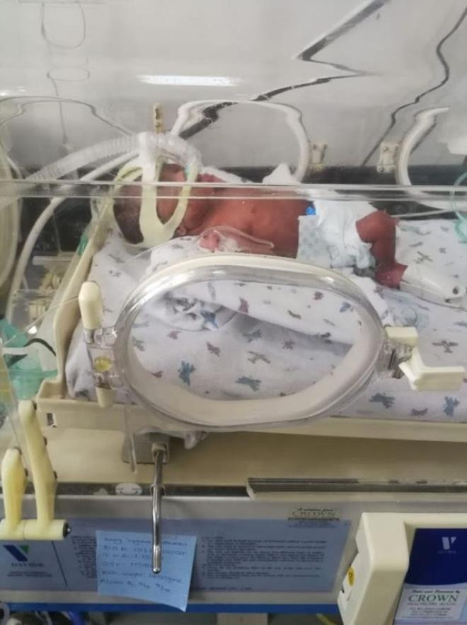 Anne doğum yaptı faturayı gören babanın sancısı tuttu. Çocukların ikisi hastanede rehin kaldı - Resim : 3