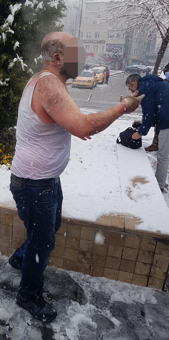 Üzerine benzin döküp kibriti çaktı - Resim : 2