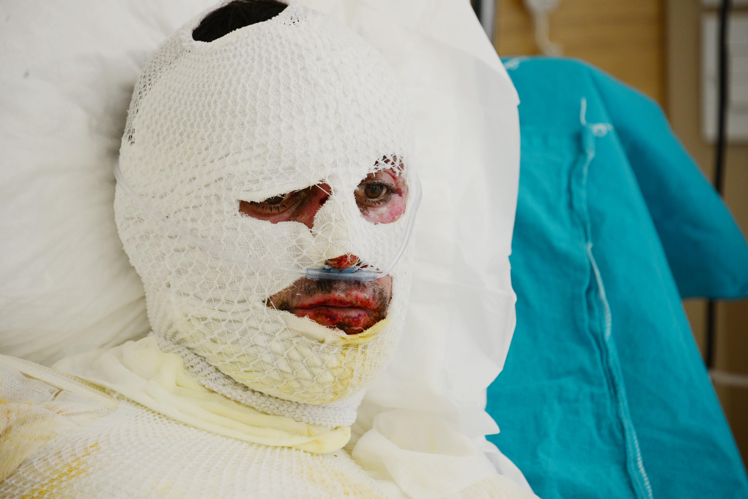 Talihsiz çoban hastanelik oldu - Resim : 3