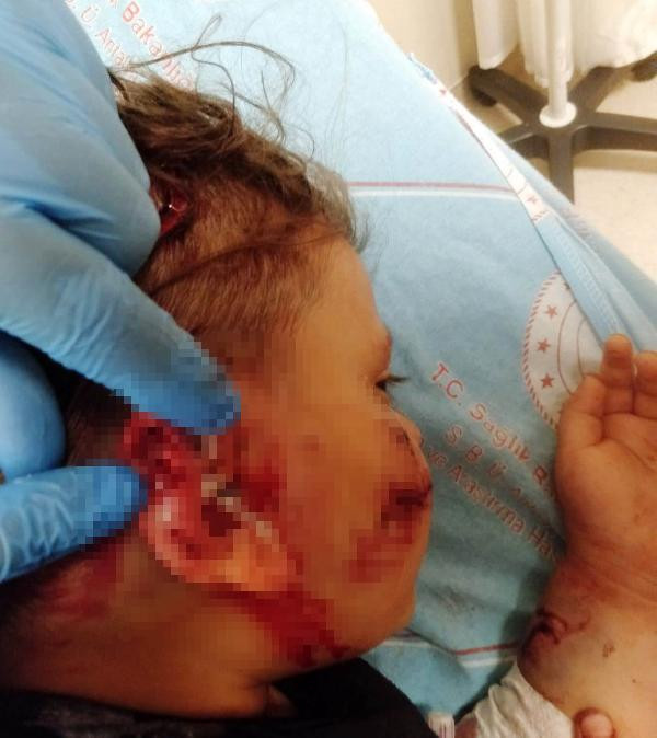 Yağız'ı kurt köpeğinin ağzından başka köpek kurtardı - Resim : 7