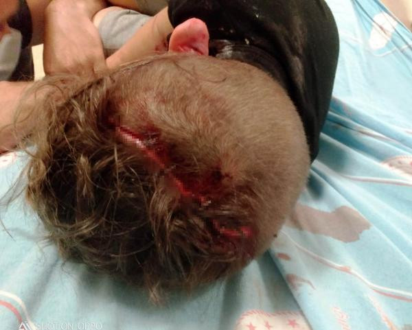 Yağız'ı kurt köpeğinin ağzından başka köpek kurtardı - Resim : 6