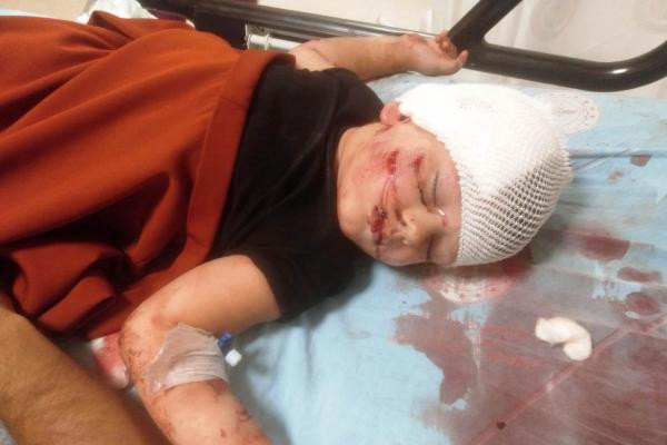 Yağız'ı kurt köpeğinin ağzından başka köpek kurtardı - Resim : 5