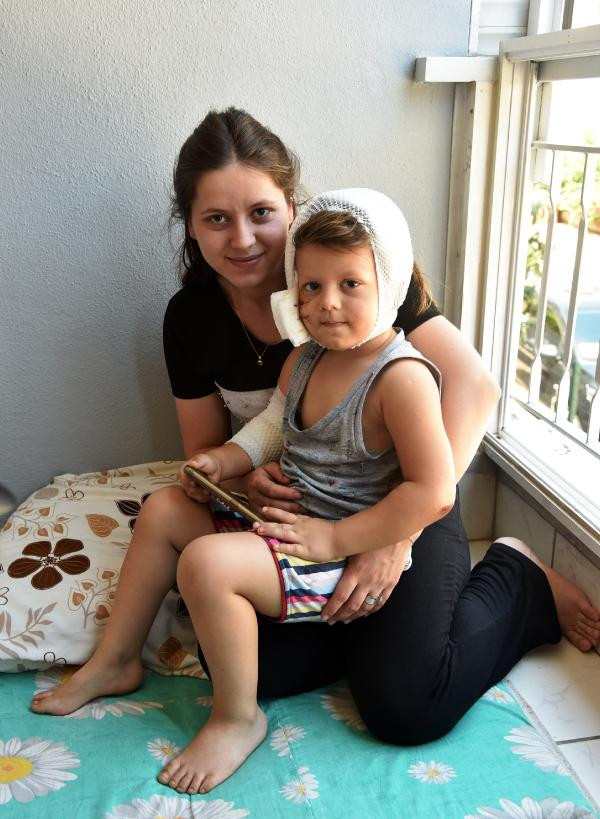 Yağız'ı kurt köpeğinin ağzından başka köpek kurtardı - Resim : 3