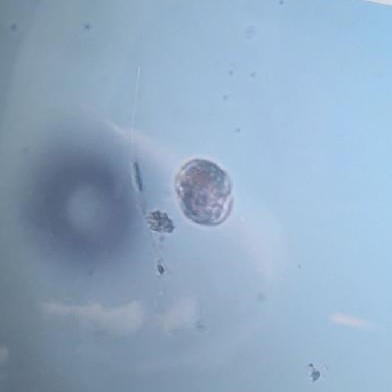 Müsilajda görmediğimiz yeni bir canlı türü bulduk - Resim : 1