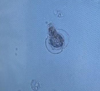 Müsilajda görmediğimiz yeni bir canlı türü bulduk - Resim : 2