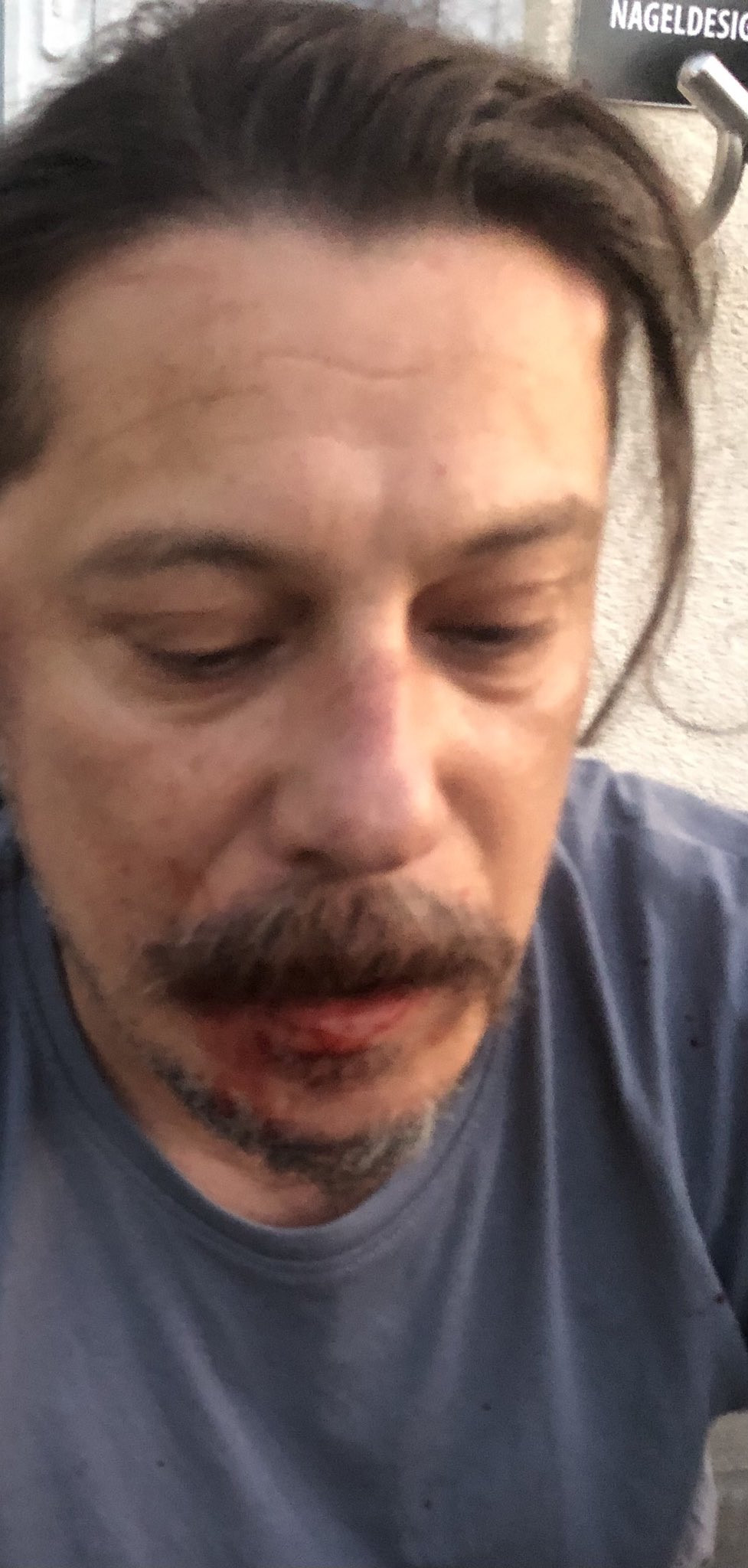 Gazeteci Erk Acarer'e bıçaklı yumruklu saldırı - Resim : 1