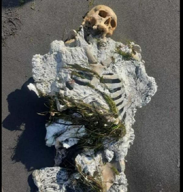 Samsun'da iskelet sahile vurdu - Resim : 3