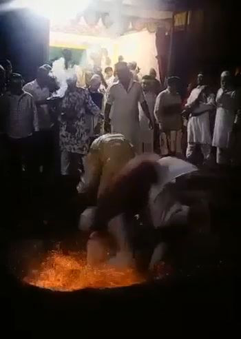 Konsantre olan değil yanındaki pişiyordu. Ateşin içine düştü bayıldı kaldı - Resim : 3