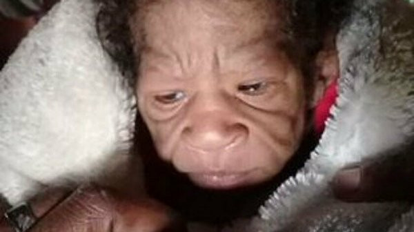 Yaşlı bedende bebek doğdu - Resim : 4