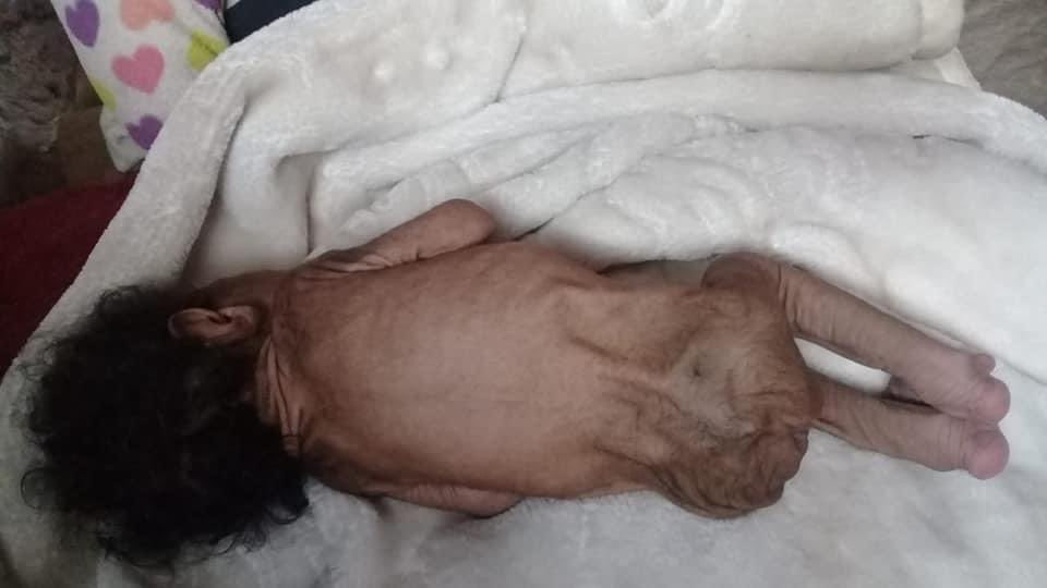 Yaşlı bedende bebek doğdu - Resim : 11