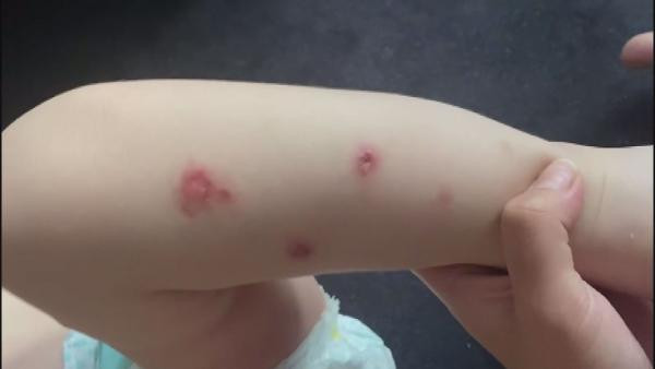 Suriyeli babadan 2 yaşındaki çocuğuna sigaralı işkenceye şoke eden savunma - Resim : 2