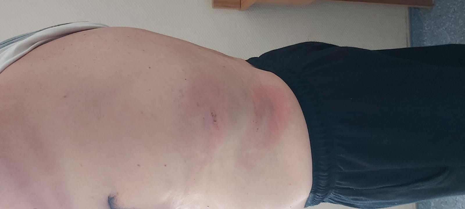 Mermer ocağını şikayet etti, saldırıya uğradı - Resim : 4