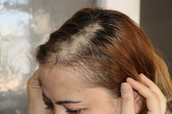 Hasta, hemşirenin saçını yoldu - Resim : 3