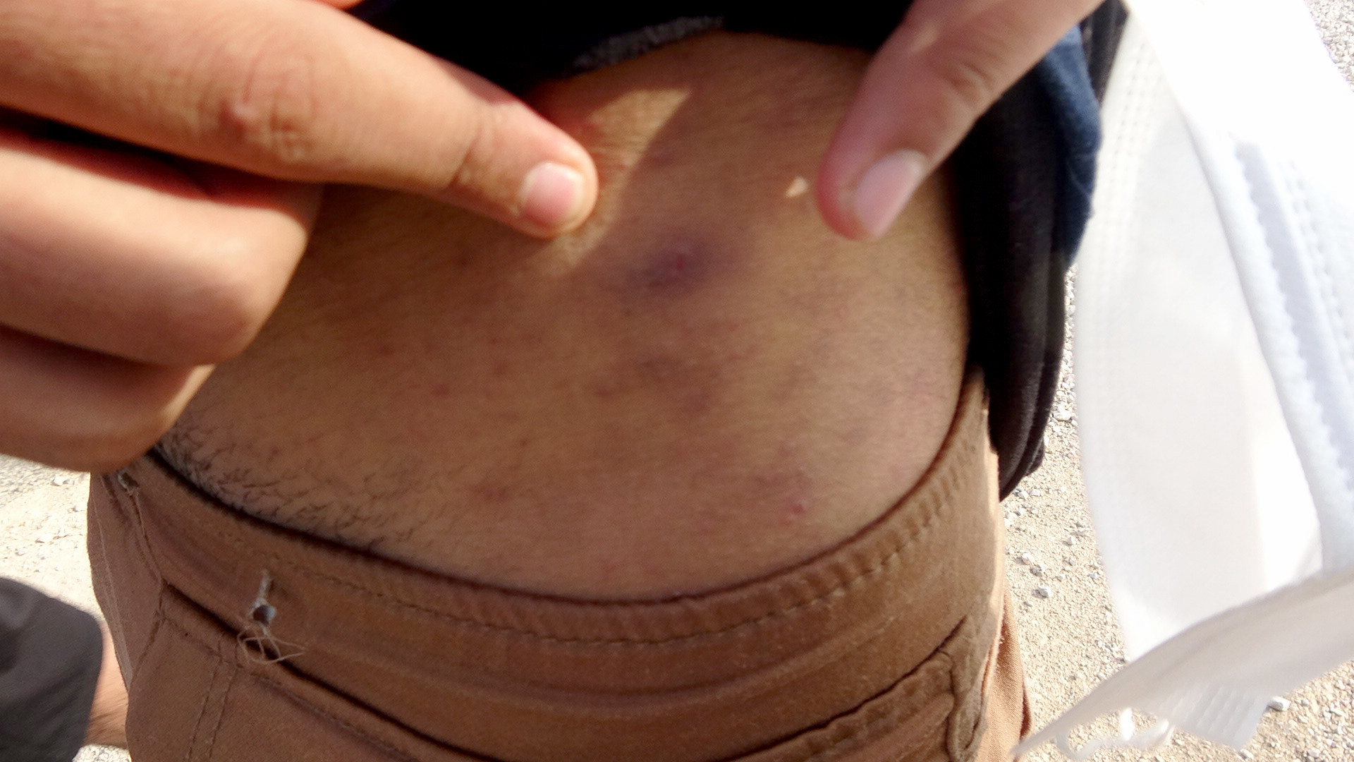 ''Bizi dövüp elektrik verdiler'' Sonra da çırılçıplak attılar - Resim : 4