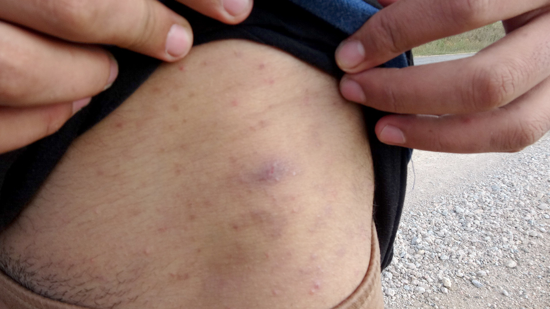 ''Bizi dövüp elektrik verdiler'' Sonra da çırılçıplak attılar - Resim : 5