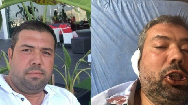 MHP’li belediye aleyhine paylaşım yapan mühendise saldırı, O anlar kamerada - Resim : 1