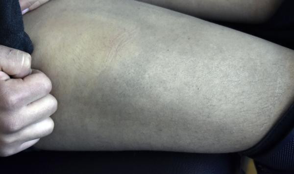 14 yaşındaki çırağa yanlış tıraş dayağı - Resim : 2