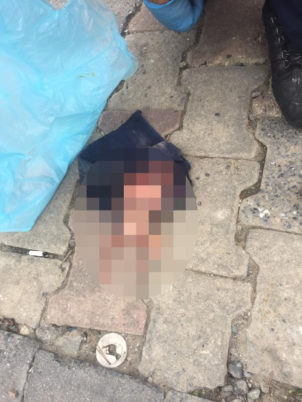 Vicdansızlar! 4 aylık ceninin çarşafa sarıp attılar - Resim : 7