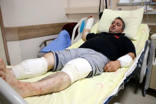 Ayı saldırısından kurtulan Şener Yıldız ‘Siz bir de ayıyı görün’ - Resim : 3