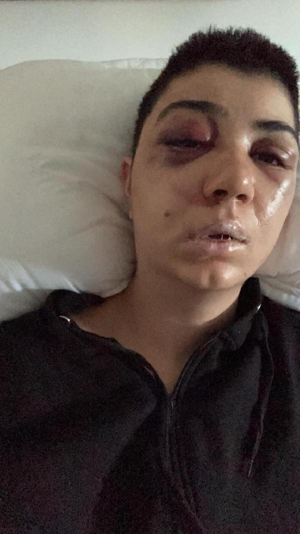 Yabancı uyruklu adam genç kızı felç edene kadar dövdü - Resim : 2