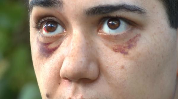 Yabancı uyruklu adam genç kızı felç edene kadar dövdü - Resim : 5