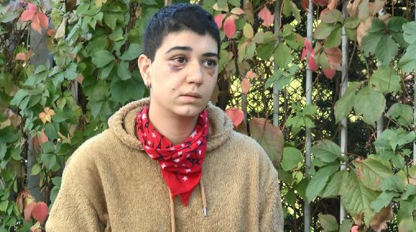 Yabancı uyruklu adam genç kızı felç edene kadar dövdü - Resim : 6