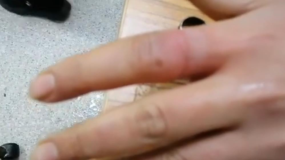 İtfaiyeden yüzük operasyonu - Resim : 3