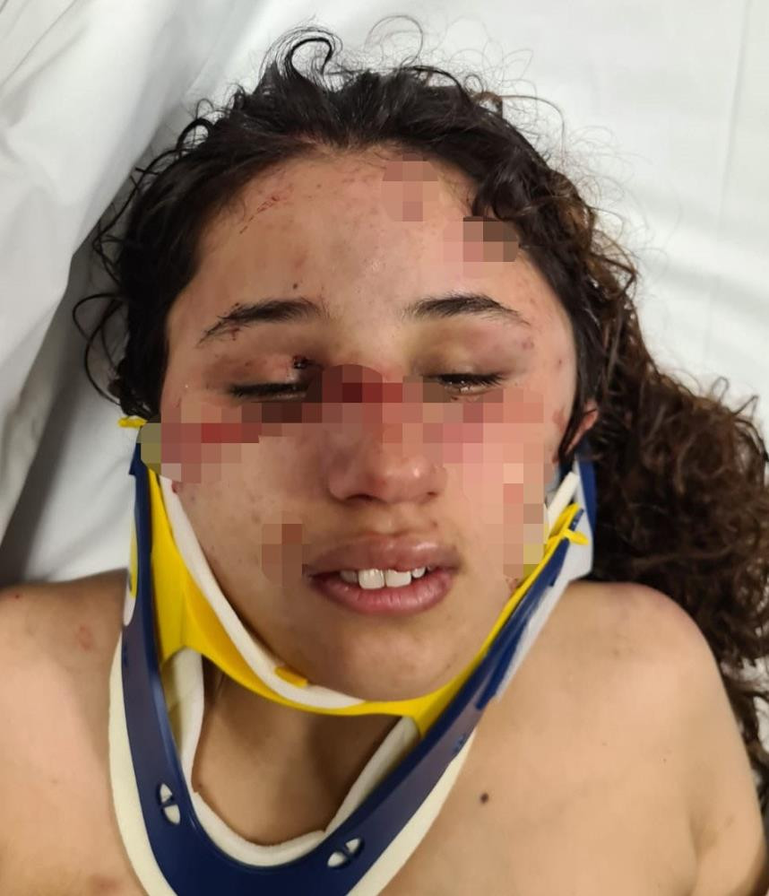 Yedi aylık hamile karısını bağlayıp vücudunda sigara söndürdü - Resim : 1