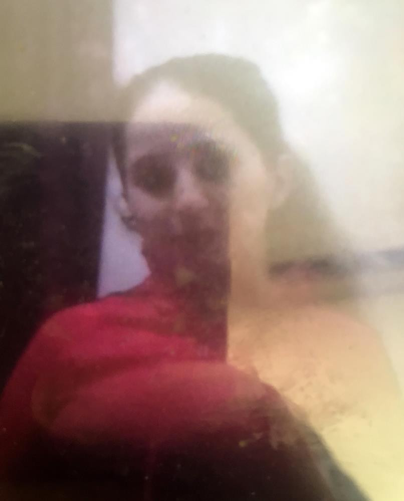 Yedi aylık hamile karısını bağlayıp vücudunda sigara söndürdü - Resim : 2