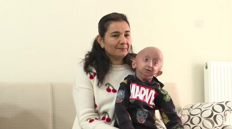 8 milyonda 1 görülüyor | 9 yaşındaki Veysel’in “Benjamin Button” hastalığıyla mücadelesi! - Resim : 2