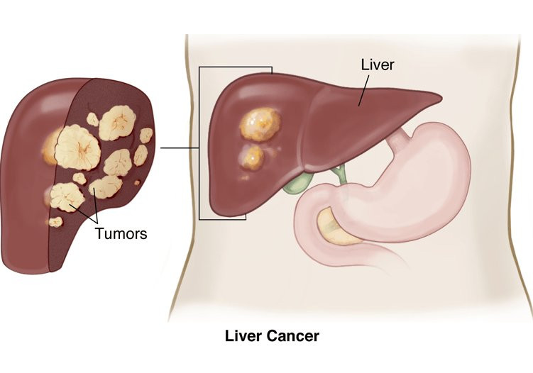 Almanya'da yeterli sağlık hizmeti alamadı. İstanbul'da tedavisi sürüyor - Resim : 2