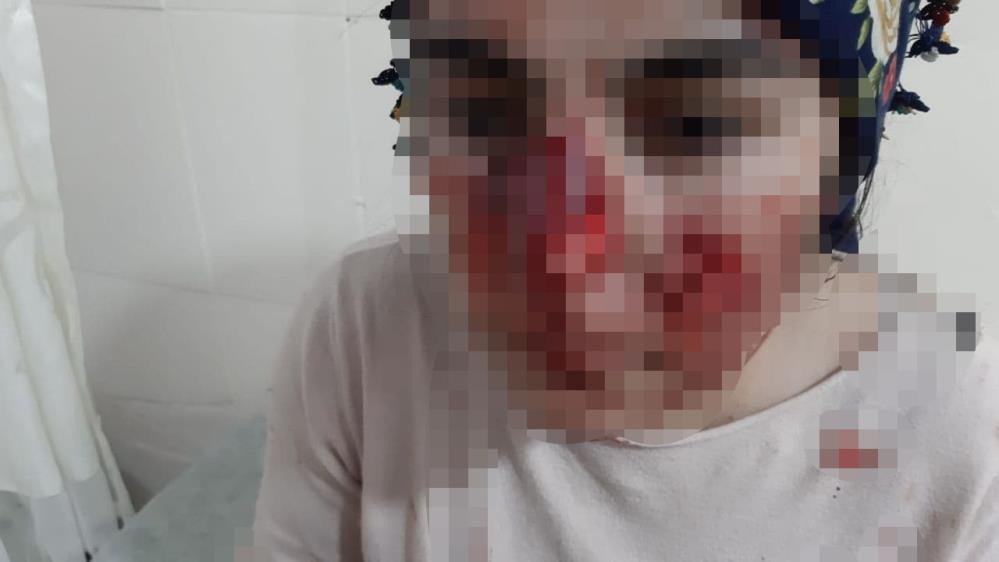 Sokak köpekleri 3 kişiye parçaladı - Resim : 2