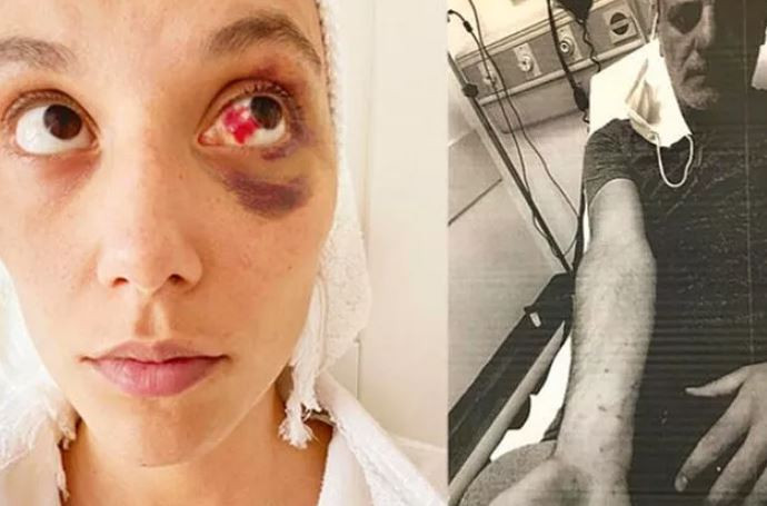 Şoförü her şeyi anlattı (15 Şubat 2022) - Resim : 2