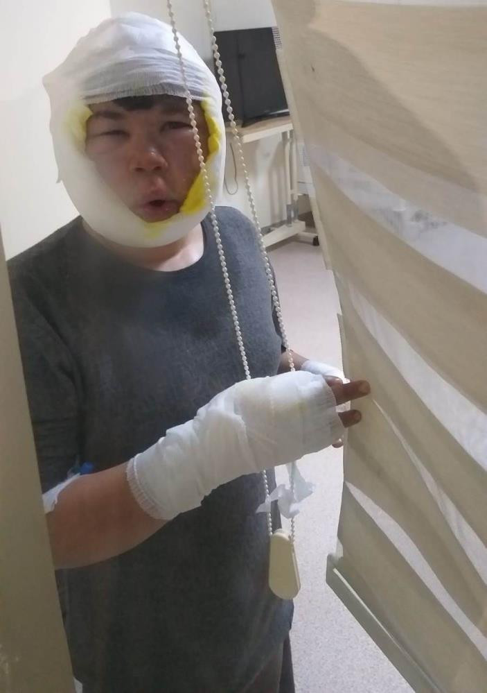 4 çocuğun oyun keyfi kabusa dönüştü - Resim : 5