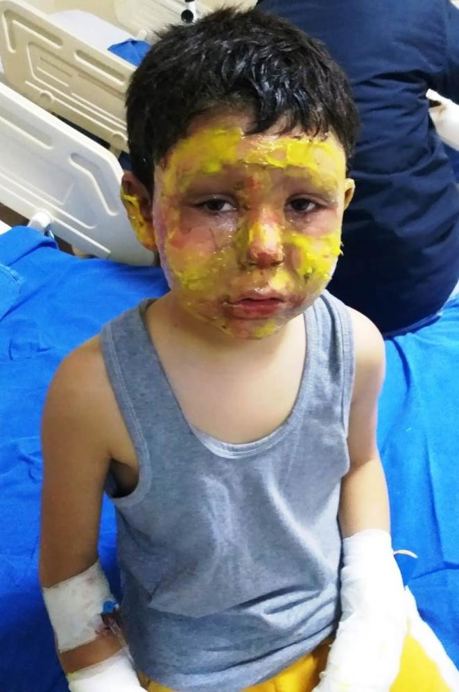 4 çocuğun oyun keyfi kabusa dönüştü - Resim : 6