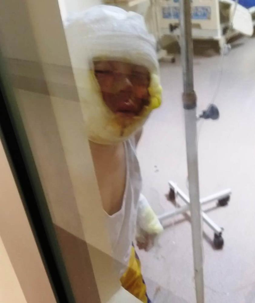 4 çocuğun oyun keyfi kabusa dönüştü - Resim : 7