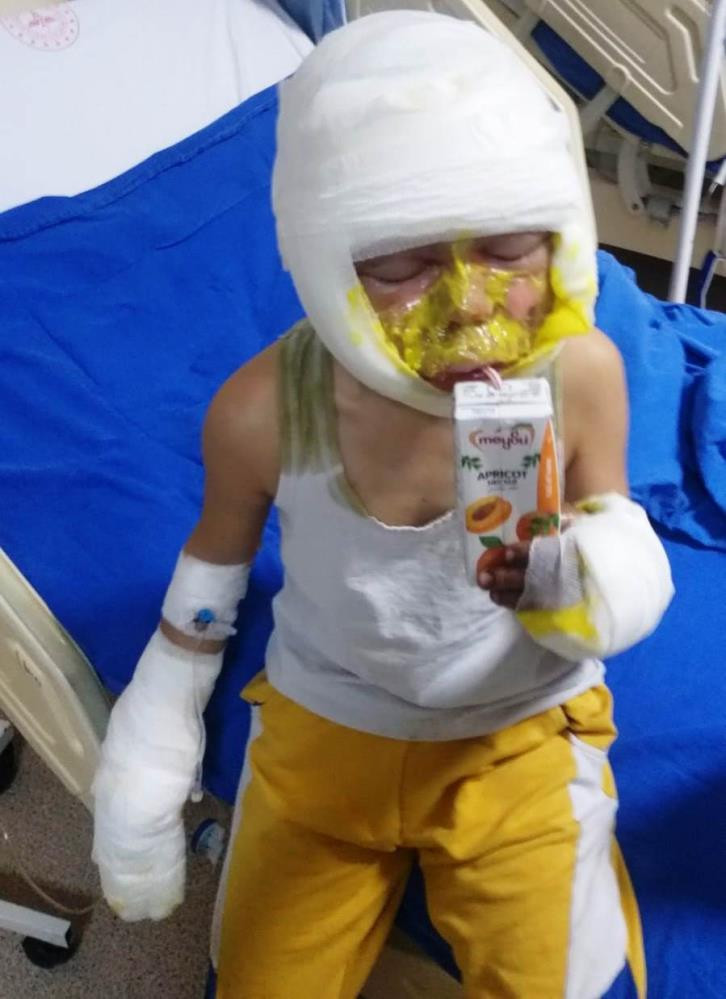 4 çocuğun oyun keyfi kabusa dönüştü - Resim : 8