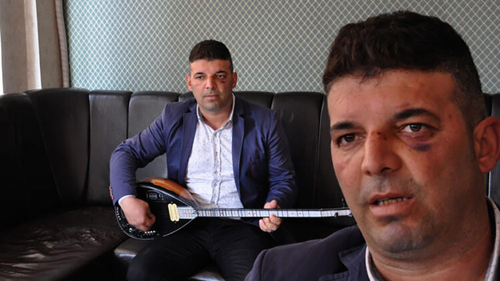 'Çocukları pistten alalım' diyen müzisyene dayak! Yazıklar olsun… - Resim : 2