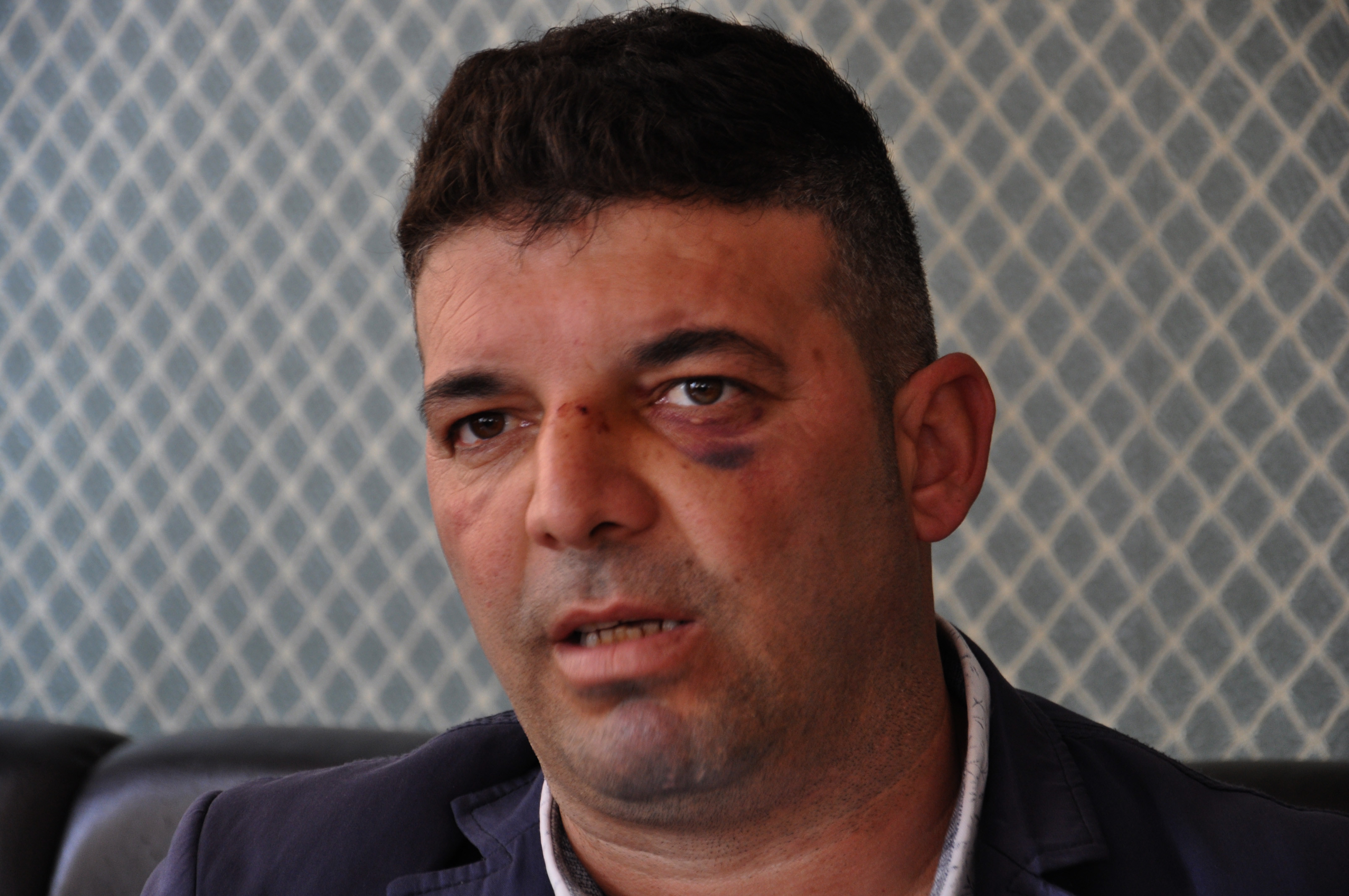 'Çocukları pistten alalım' diyen müzisyene dayak! Yazıklar olsun… - Resim : 6