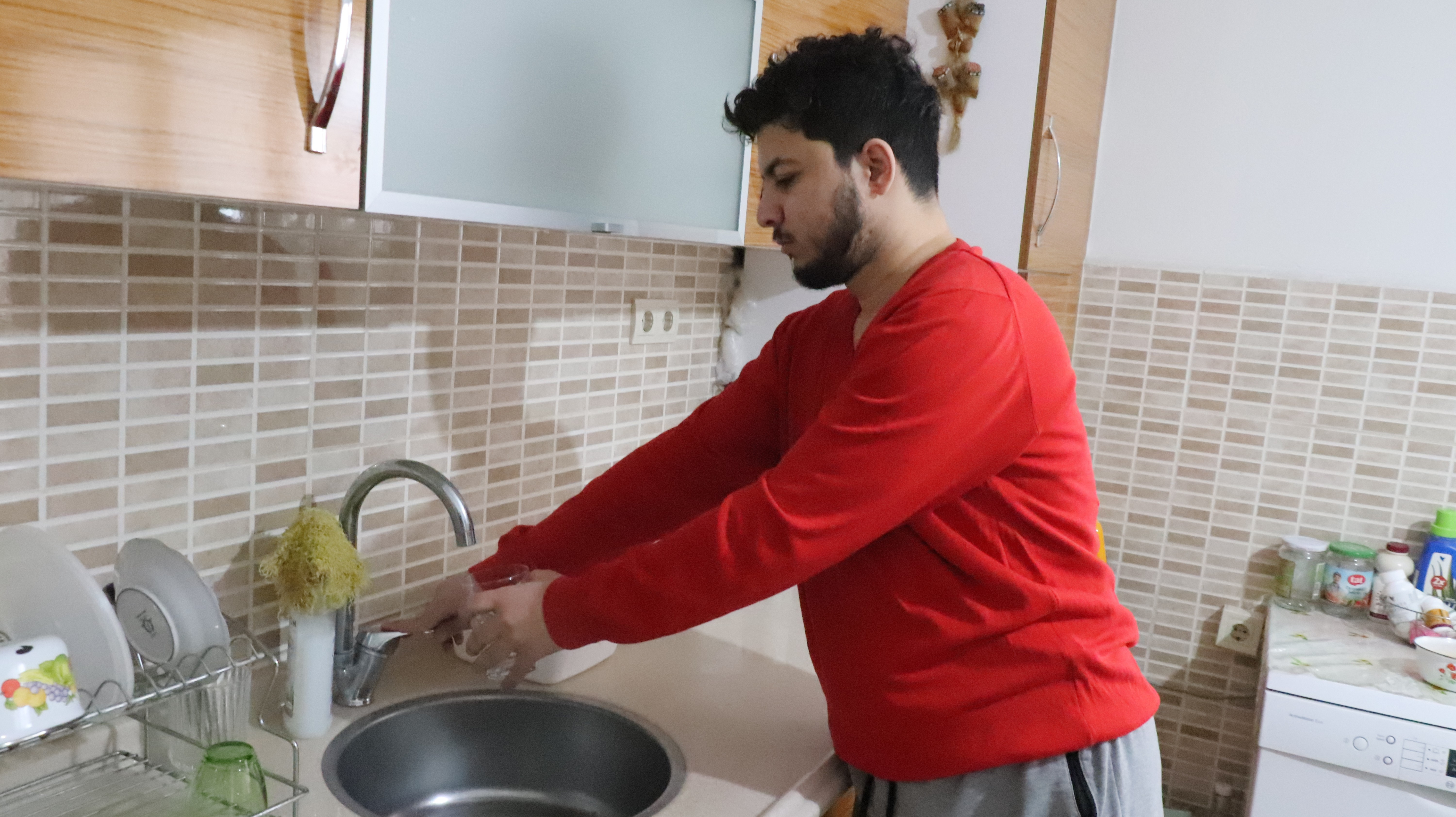 Hastalığı ile tıp tarihine geçti. Doktorlar tanı bile koyamıyor - Resim : 2