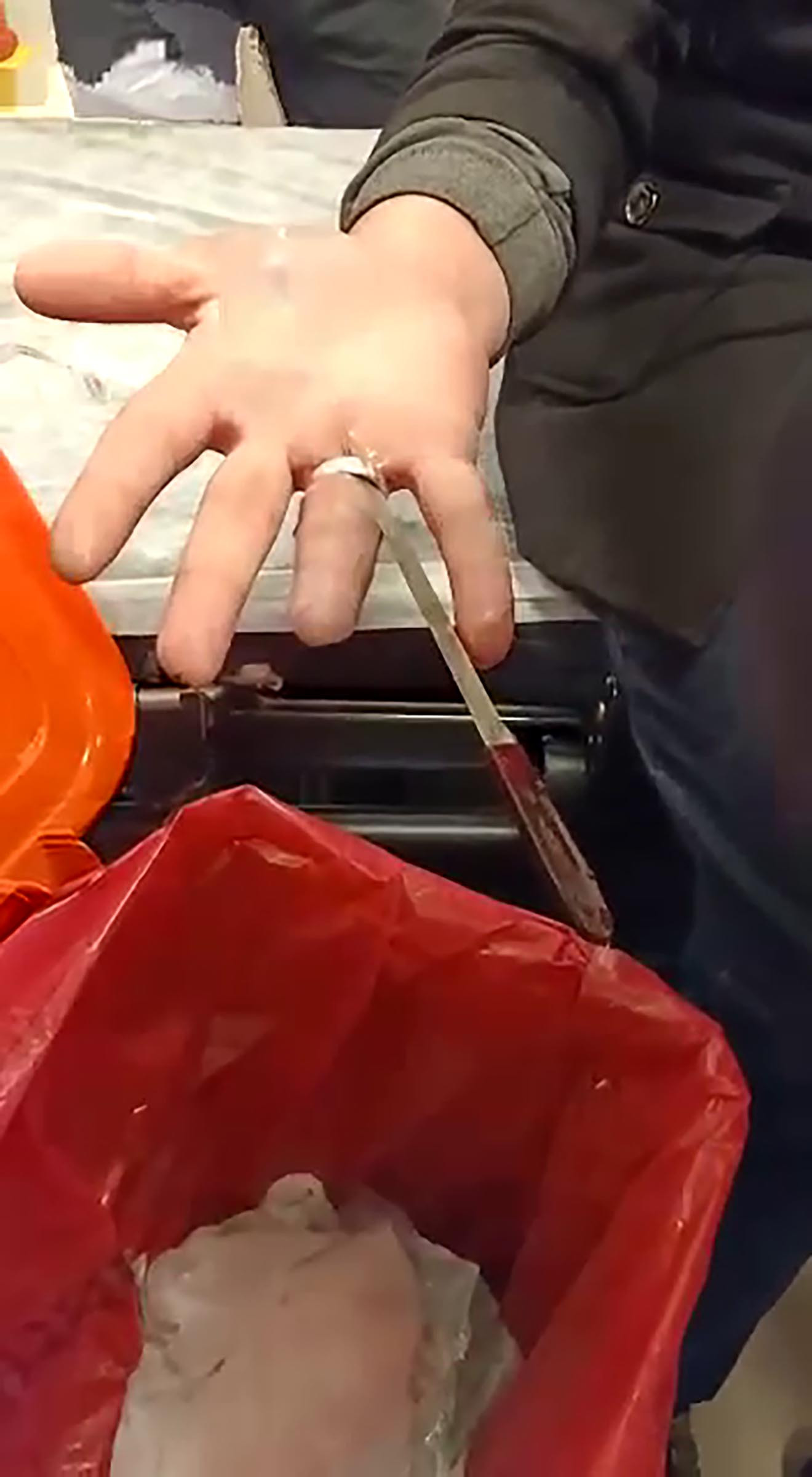 İtfaiyeden acil serviste ‘yüzük’ operasyonu - Resim : 5