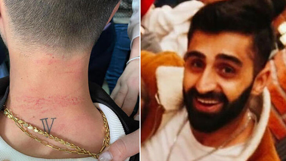 Cerrahpaşa'da doktora saldıran sanığa istenen ceza belli oldu - Resim : 2