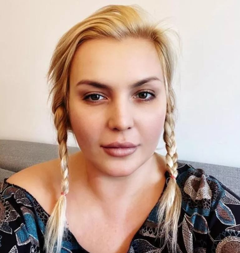 Sunucu Seda Akgül'ün, son halini görenler Survivor yarışmacısı Sude'ye benzettiler - Resim : 2