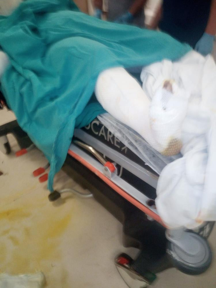 Sevgilisini testerenin benziniyle yakıp öldürdü - Resim : 4