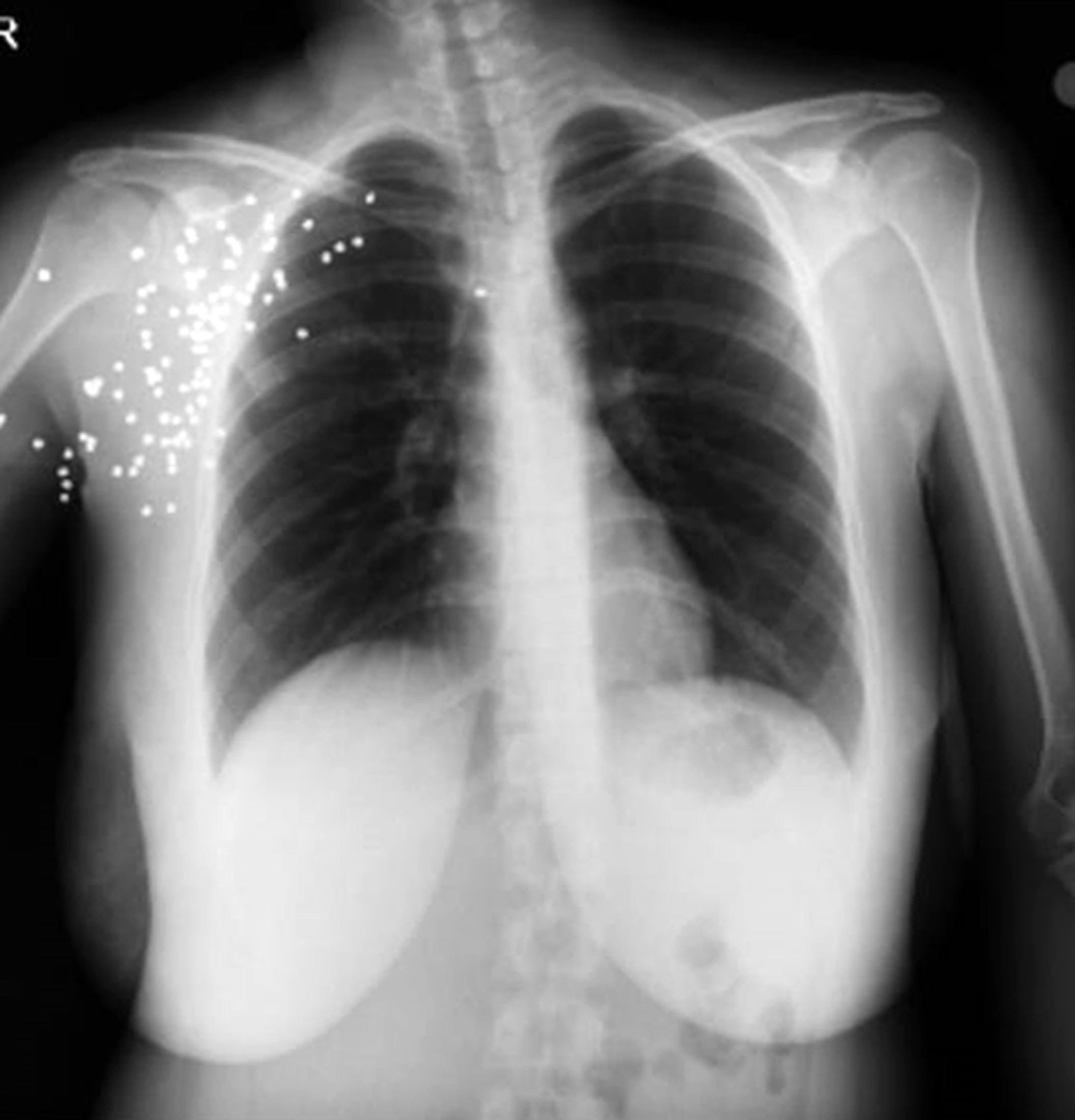 İnternetten tanışıp evlendiği eski eşi kabusu oldu - Resim : 5