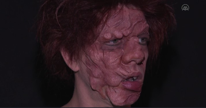 Bakın bu hale nasıl geldi - Resim : 2