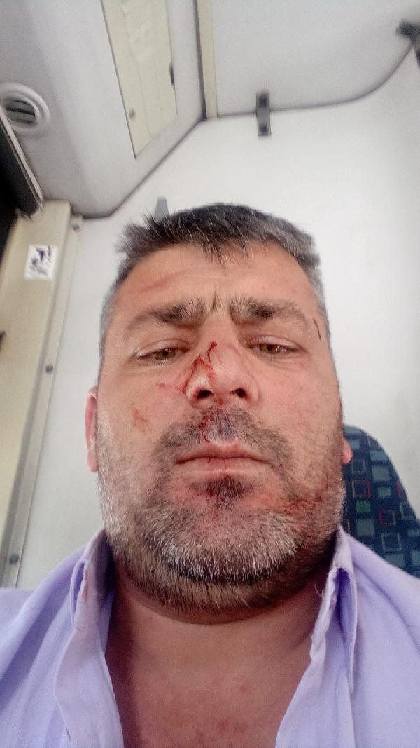 Saldırıya maruz bırakılan İETT şoförü Tarık Akçam (DHA)