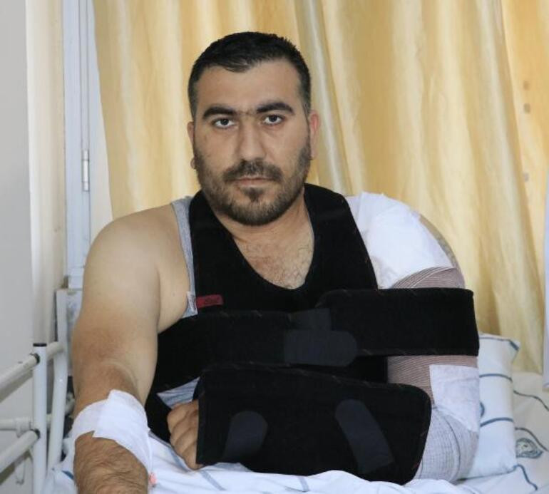 Bacağından alınan kemik, kolunu kesilmekten kurtardı - Resim : 1