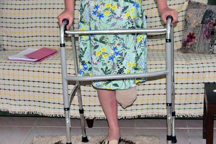 Eşini vurup bacağının kesilmesine neden olan kocanın cezası belli oldu - Resim : 2