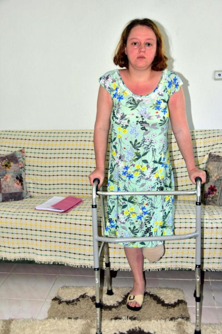 Eşini vurup bacağının kesilmesine neden olan kocanın cezası belli oldu - Resim : 5